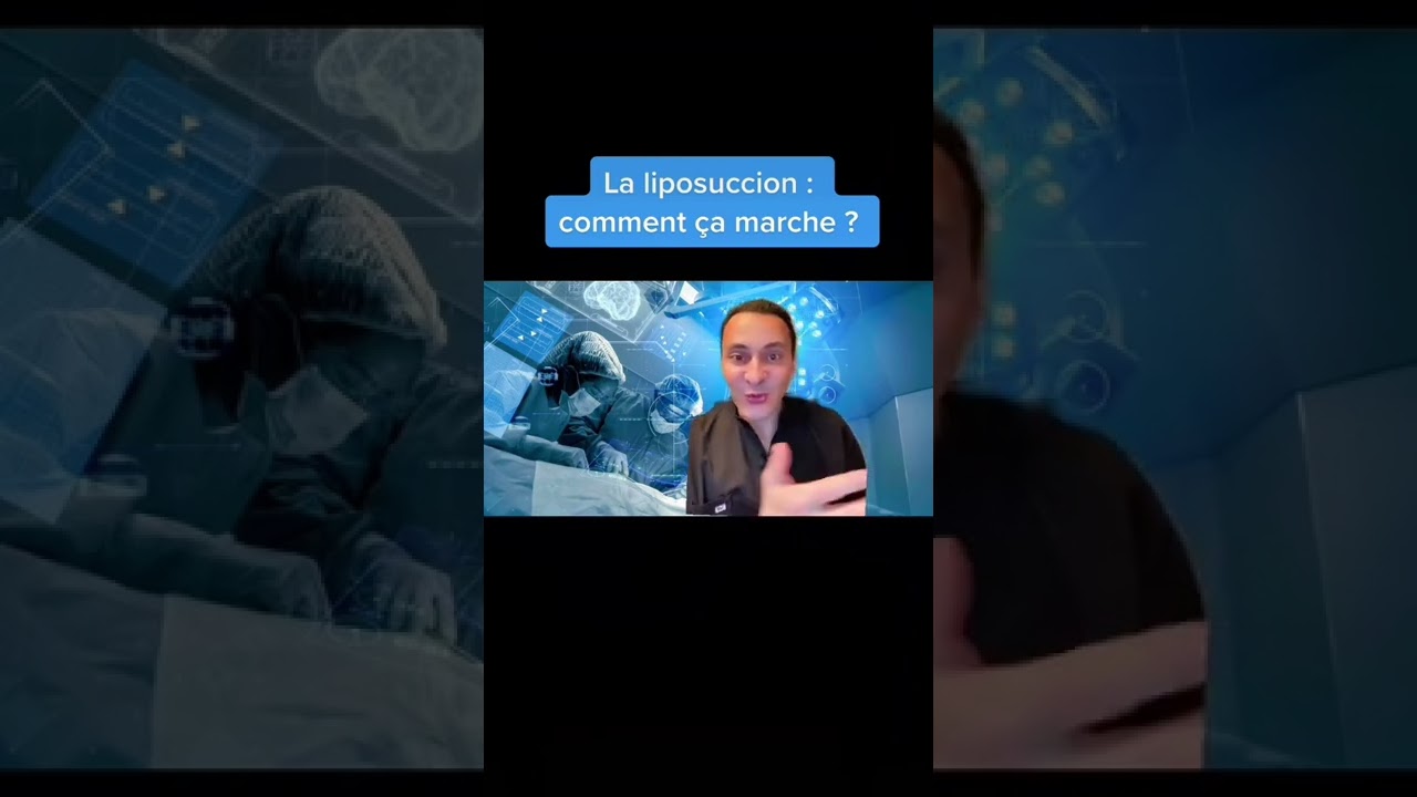 La liposuccion : comment ça marche ?